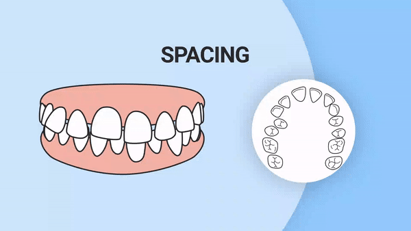 Teeth spacing GIF